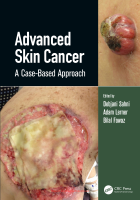 Advanced Skin Cancer A Case-Based Approach.pdf